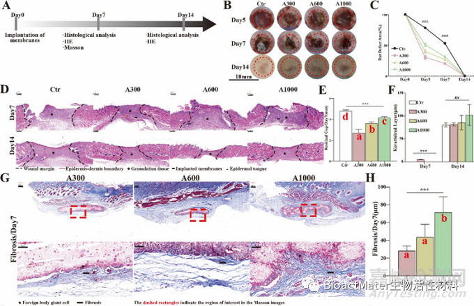 取向電紡膜纖維直徑通過免疫方式加速上皮化促進傷口愈合