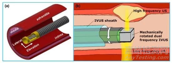 冠脈血管疾病的三大評估器械：IVUS、OCT、FFR