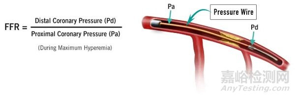 冠脈血管疾病的三大評估器械：IVUS、OCT、FFR