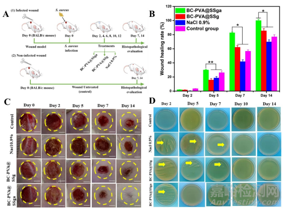 一種用于治療慢性傷口感染的傷口敷料