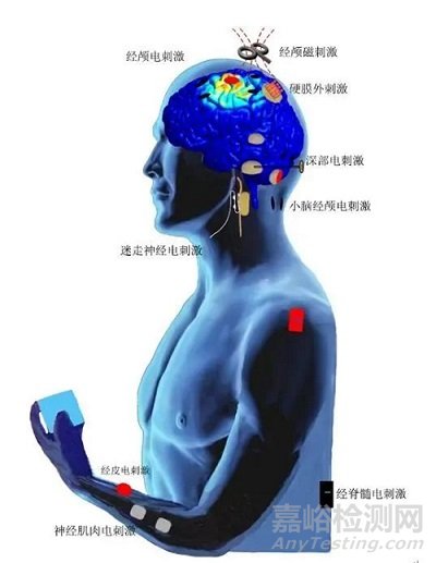 物理因子輔助運(yùn)動(dòng)和感覺康復(fù)的研究介紹與應(yīng)用現(xiàn)狀