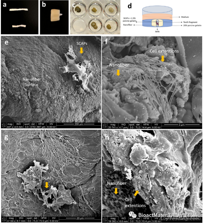 用于牙髓再生程序的抗菌膜和免疫調節(jié)可吸收納米纖維銼