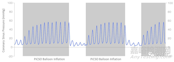 PiCSO:FDA批準(zhǔn)革命性急性心肌梗死進行IDE研究
