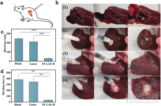 ?15秒超快凝膠化！可注射、抗菌、可降解止血水凝膠，可用于治療不可壓迫性出血