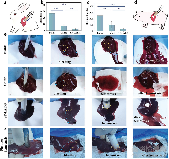 ?15秒超快凝膠化！可注射、抗菌、可降解止血水凝膠，可用于治療不可壓迫性出血