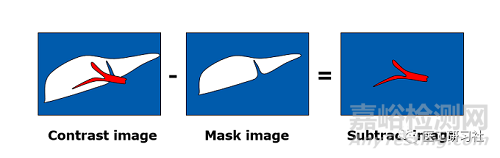 數(shù)字減影血管造影DSA發(fā)展趨勢