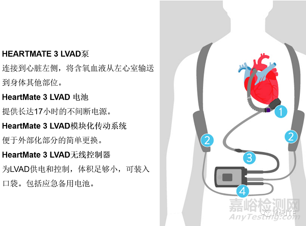 HeartMate 3:最新研究顯示至少能延長患者5年壽命
