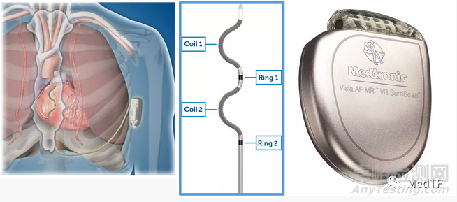 EV ICD：美敦力血管外ICD實現(xiàn)98.7%的除顫成功率