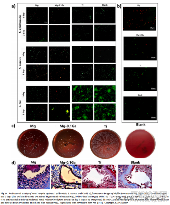 含鎵的生物活性材料在抗癌、抗菌和成骨性能方面的綜述