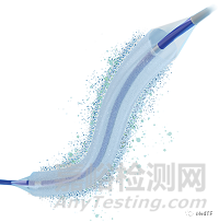 Selution SLR:完成首例載藥球囊治療勃起功能障礙