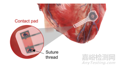 可溶解在體內(nèi)的心臟起搏器研究進(jìn)展
