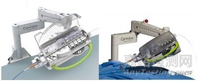 CorPath GRX：完成首個(gè)機(jī)器人輔助神經(jīng)介入血管瘤栓塞臨床研究