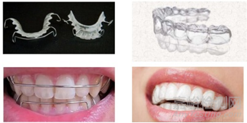 口腔保持器注冊(cè)審查指導(dǎo)原則發(fā)布（附全文）