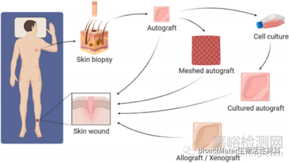 皮膚再生噴霧產(chǎn)品的研究進(jìn)展