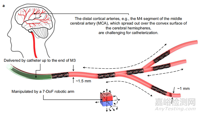 師從世界著名微小尺度機器人先驅(qū)，哈工大校友研發(fā)新型支架狀軟體醫(yī)療設(shè)備