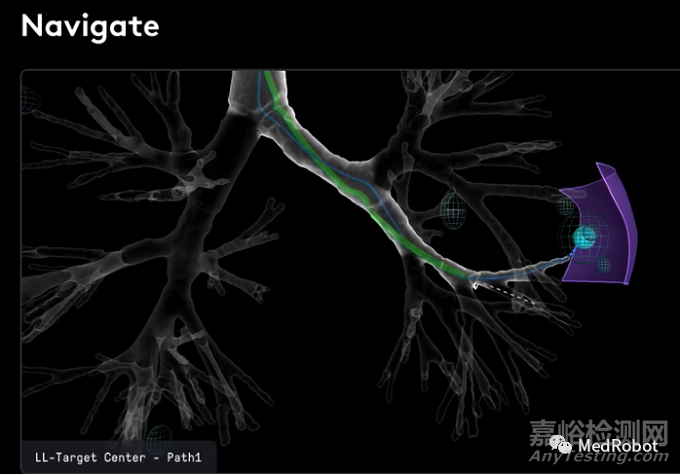 直覺(jué)外科發(fā)布經(jīng)自然腔道手術(shù)機(jī)器人Ion