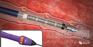 enVVe:經(jīng)導(dǎo)管靜脈瓣置換技術(shù)