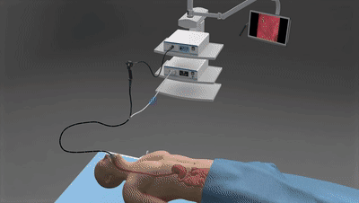 自推進(jìn)內(nèi)窺鏡技術(shù)與專利分析