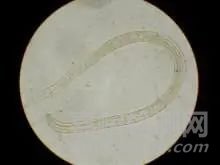 工作環(huán)境中的霉菌超標怎么處理？霉菌污染來源及防治方法詳解！