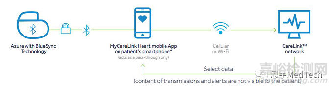 植入式心臟起搏器的類型、風險與代表產(chǎn)品