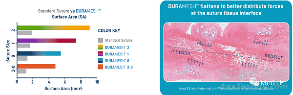 DURAMESH:全球唯一的網(wǎng)狀縫線 縫線二十年來最大創(chuàng)新