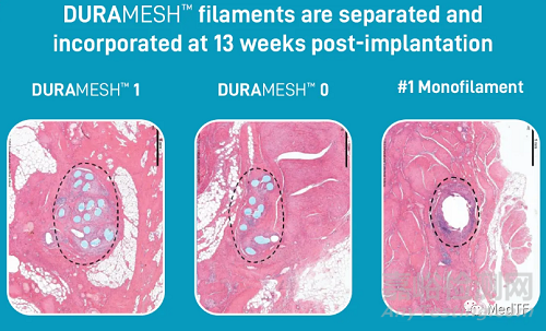 DURAMESH:全球唯一的網(wǎng)狀縫線 縫線二十年來最大創(chuàng)新