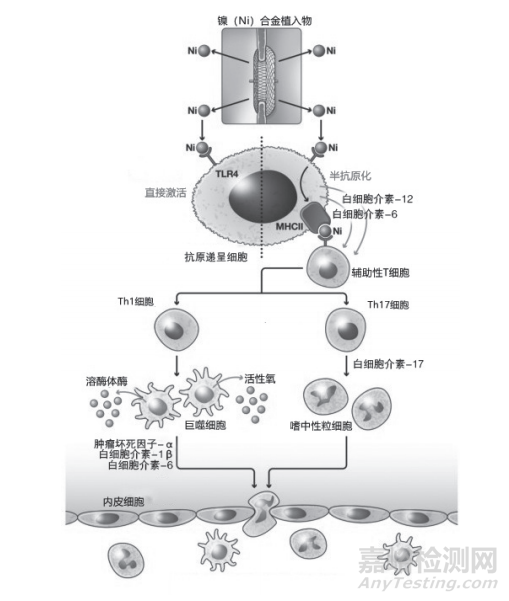 鎳合金醫(yī)療器械過敏的研究進(jìn)展