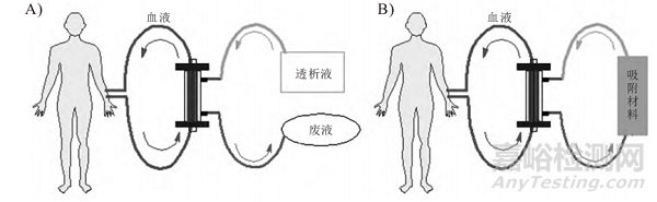新型血液透析技術(shù)與代表產(chǎn)品