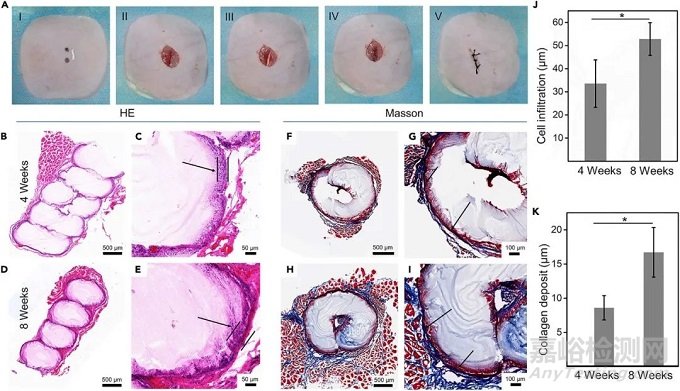 可拉伸螺旋納米纖維支架用于運動型組織動態(tài)再生