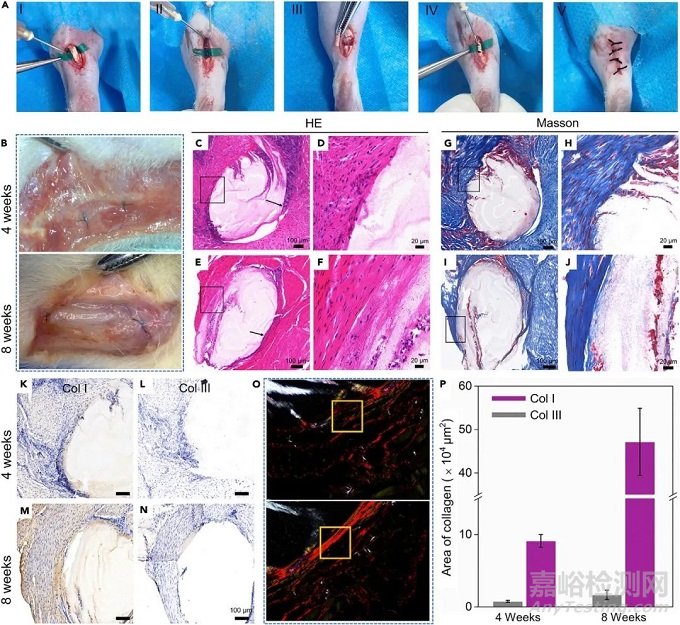 可拉伸螺旋納米纖維支架用于運動型組織動態(tài)再生