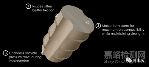 骶髂關(guān)節(jié)固定系統(tǒng)獲批FDA