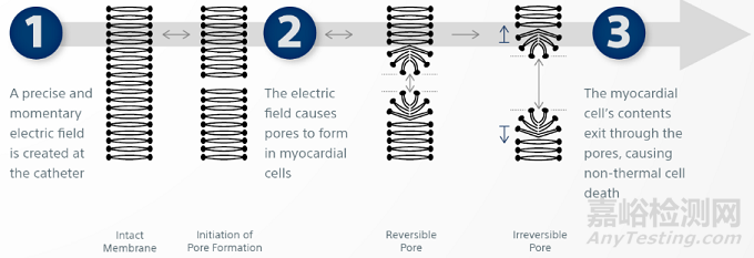 脈沖電場消融器械技術(shù)與專利分析