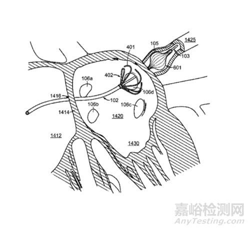 脈沖電場消融器械技術(shù)與專利分析