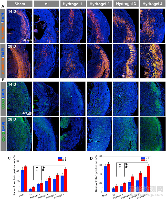 經(jīng)導(dǎo)管微創(chuàng)介入心衰治療可注射水凝膠研究取得新突破