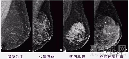 乳腺影像診斷設(shè)備及新技術(shù)進(jìn)展