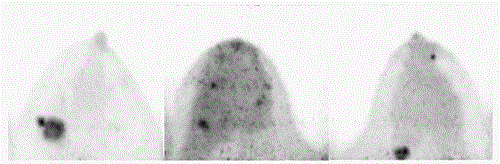 乳腺影像診斷設(shè)備及新技術(shù)進(jìn)展