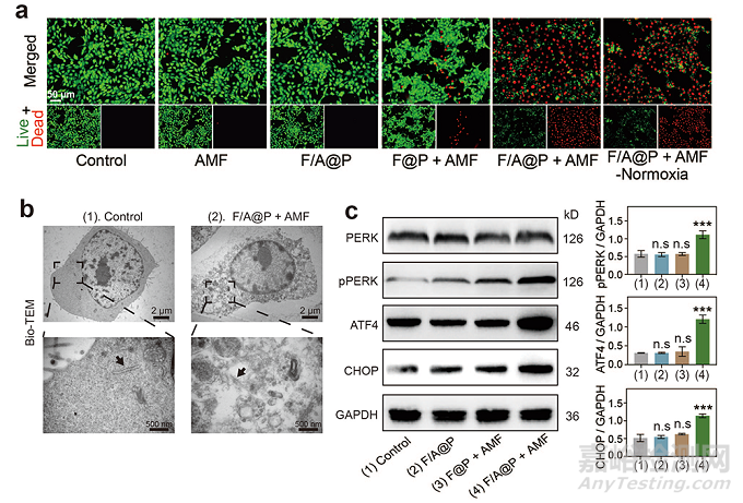 基于液固轉(zhuǎn)化多功能植入物的磁熱動(dòng)力免疫治療策略增強(qiáng)抗三陰乳腺癌療效