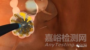 Heliostar:強(qiáng)生正式在歐洲推出第一款射頻消融球囊導(dǎo)管