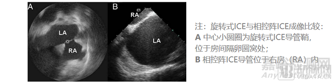 心腔內(nèi)超聲(ICE)行業(yè)研究