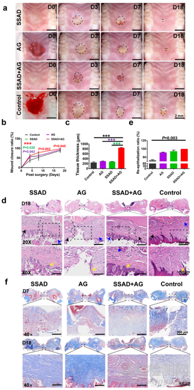 可用于促進傷口愈合的局部緩釋藥物水凝膠