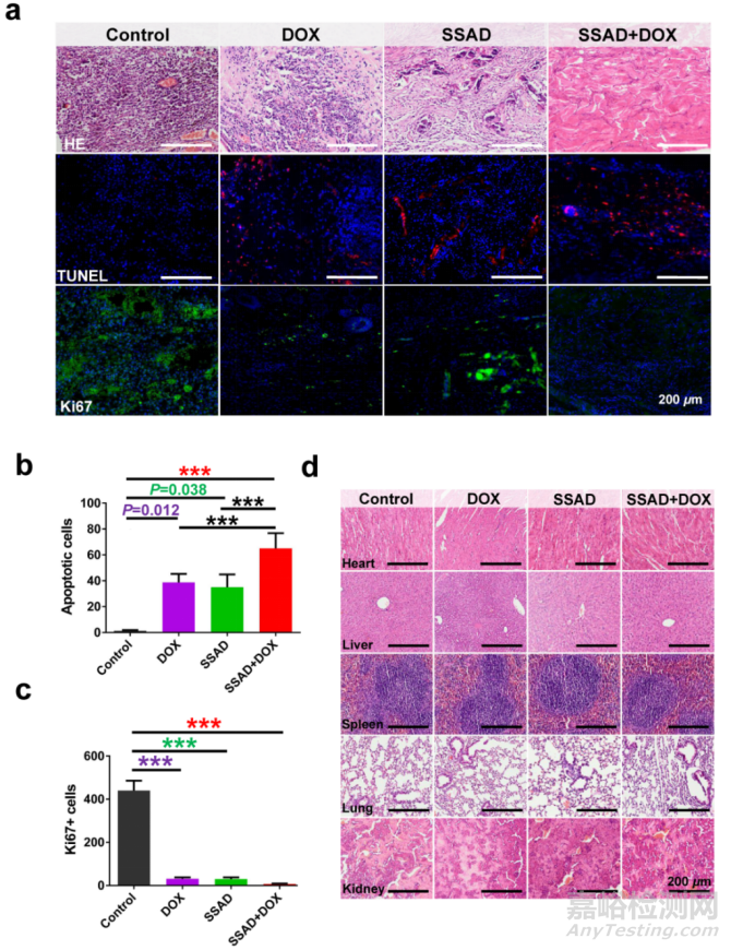 可用于促進傷口愈合的局部緩釋藥物水凝膠