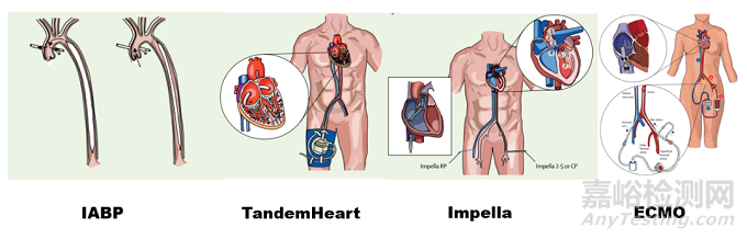 常見臨時機械循環(huán)支持裝置特點