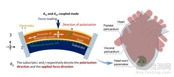 植入式心臟起搏器技術(shù)發(fā)展趨勢(shì)