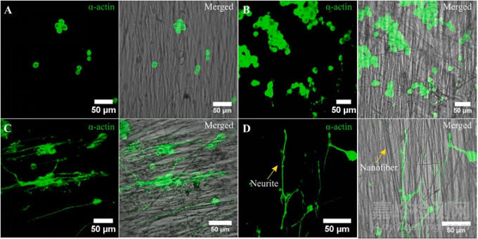 用于組織修復生物可降解熱塑性聚氨酯的設計