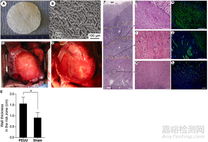 用于組織修復生物可降解熱塑性聚氨酯的設計