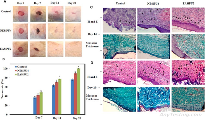 用于組織修復生物可降解熱塑性聚氨酯的設計