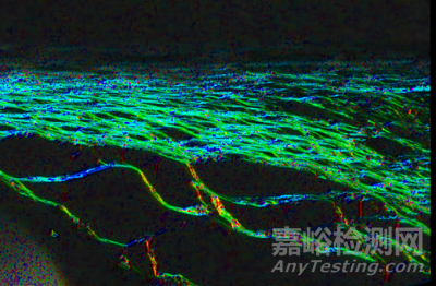 新的植入式裝置設(shè)計或?qū)⑼苿尤斯ひ认侔l(fā)展