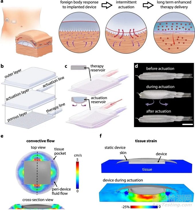 新的植入式裝置設(shè)計或?qū)⑼苿尤斯ひ认侔l(fā)展