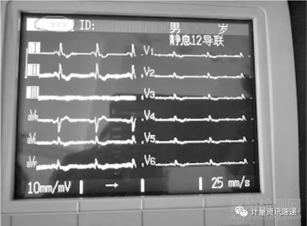 光電數(shù)字心電圖機(jī)計量檢定心率不顯示問題的探討
