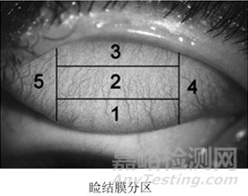 軟性接觸鏡同品種臨床評價注冊審查指導原則征求意見（附全文）